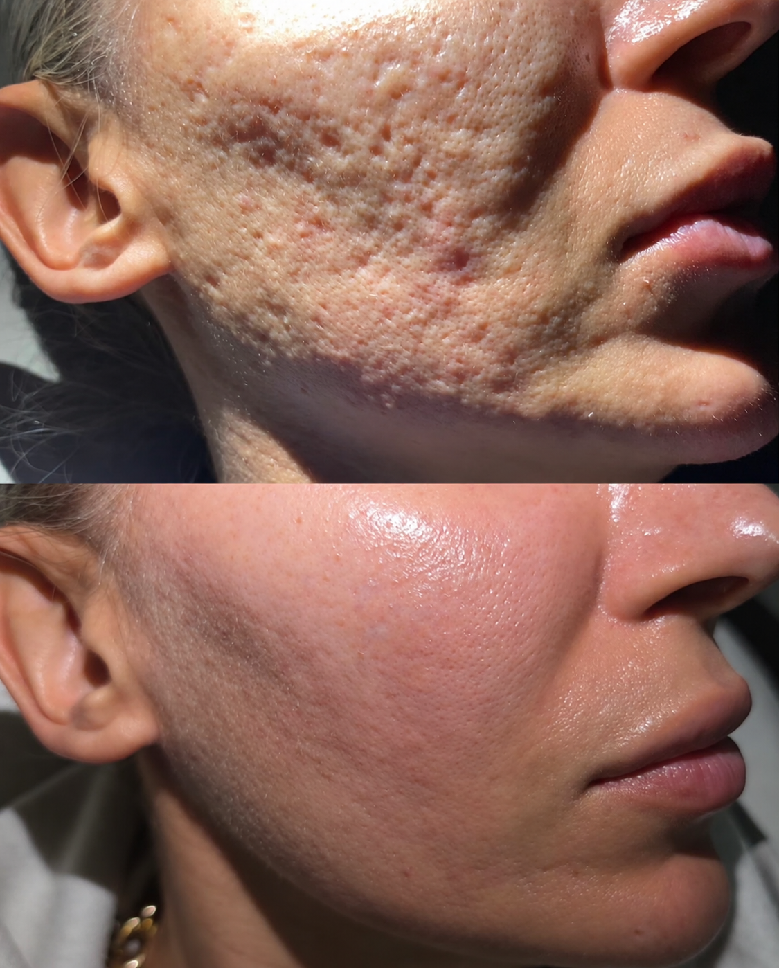 Client skin result image
