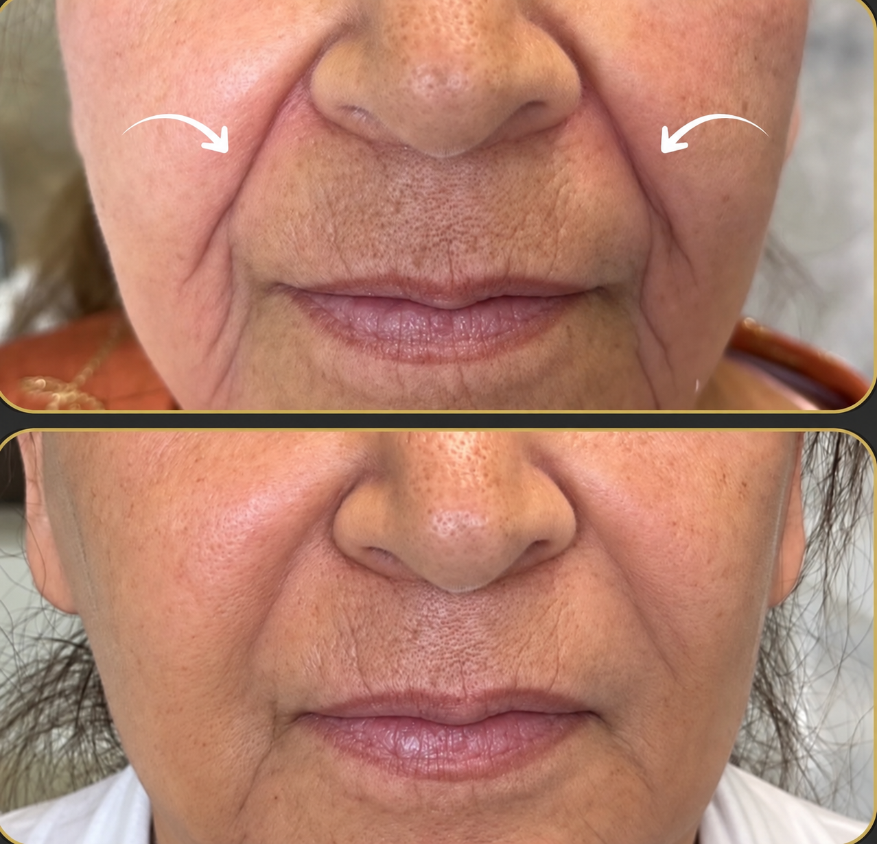 Client facial result image
